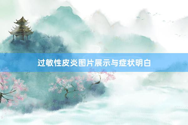 过敏性皮炎图片展示与症状明白